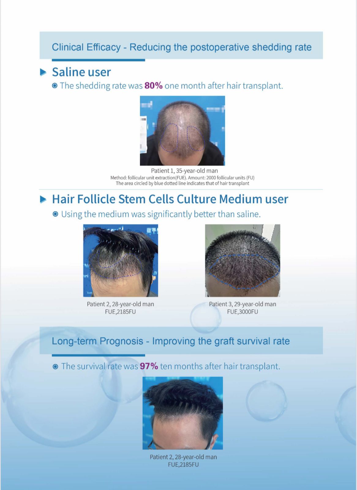 HAIR FOLLICAL STEMS CELL CULTURE